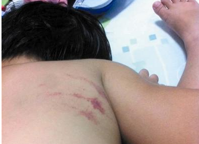 3ŮֶͯദˡʦֻǰѺһֱ