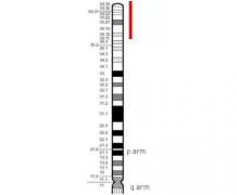 ɺӵȾɫĩȱʧ1p36 deletionۺ