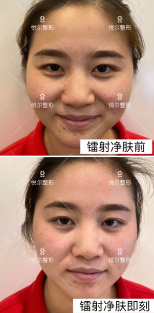 1596447062889418.png image.png