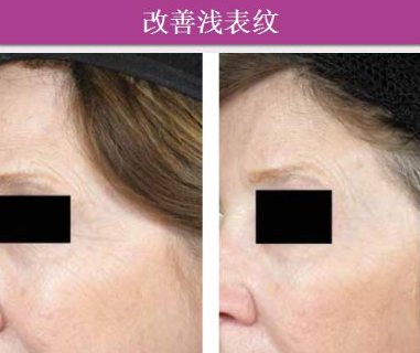 1607301826977132.png 微信图片_20201207083027.png