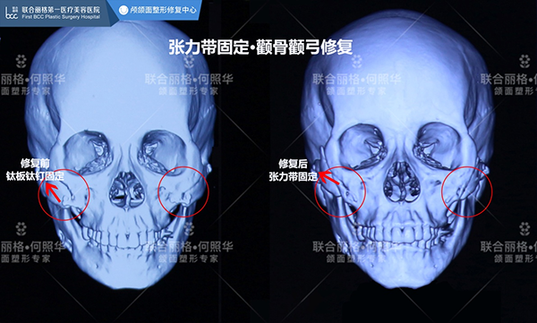 1610935952985196.png 图片1.png