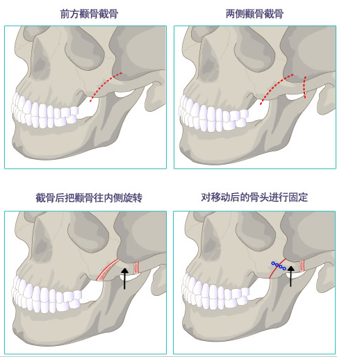 1610935992775206.png 图片3.png