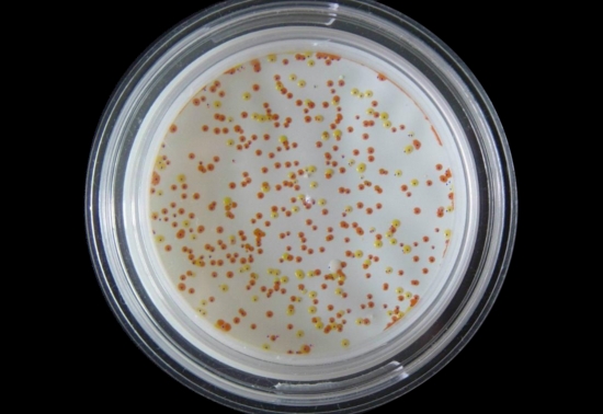 金黄色葡萄球菌