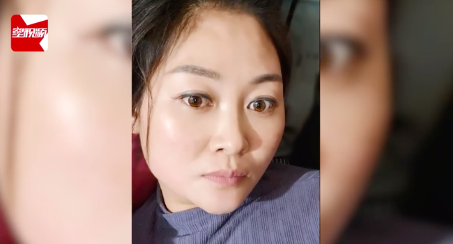 奥密毁容？女子感染新冠高烧后满脸发黑 
