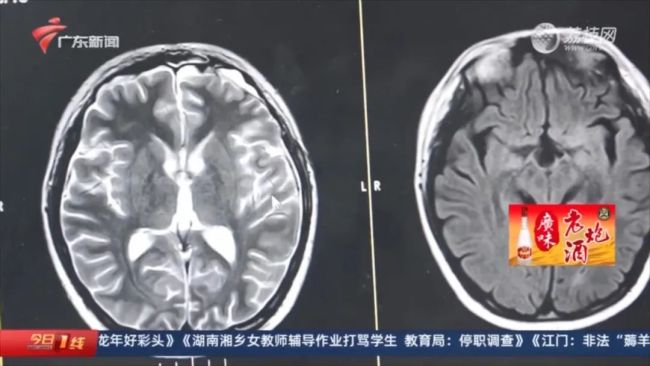 男孩一天喝9升水被查出肿瘤 家属：平时喜欢自言自语 找陌生人聊天