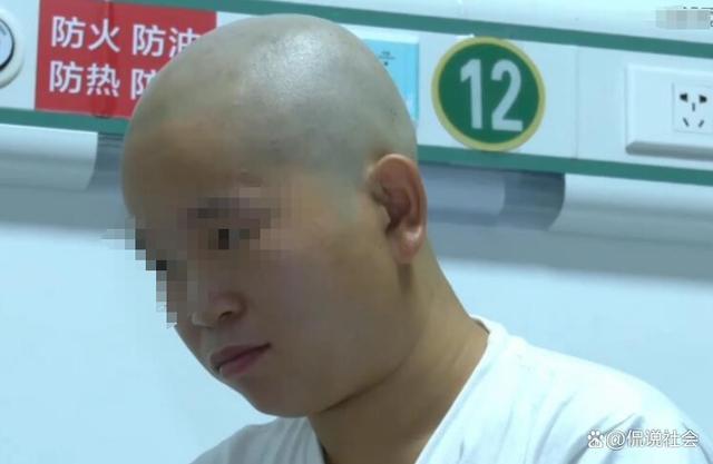 姐弟烧伤四位姨妈剃光头捐头皮：为了救孩子怎么样都行