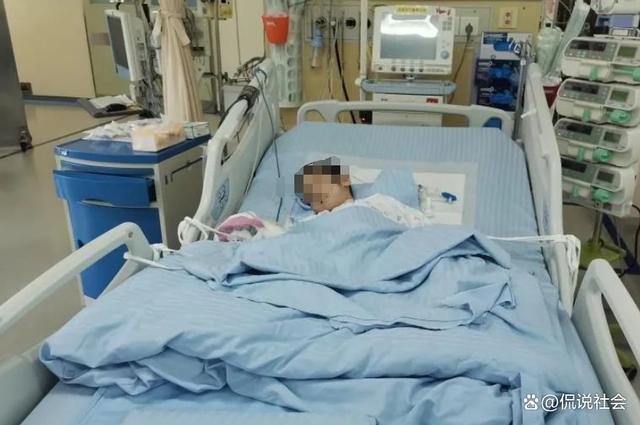 姐弟烧伤四位姨妈剃光头捐头皮：为了救孩子怎么样都行
