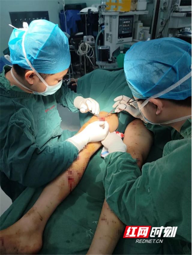 宠物变猛兽？13岁男孩遭自家狗撕咬近百处伤口 手术治疗时间长达5小时
