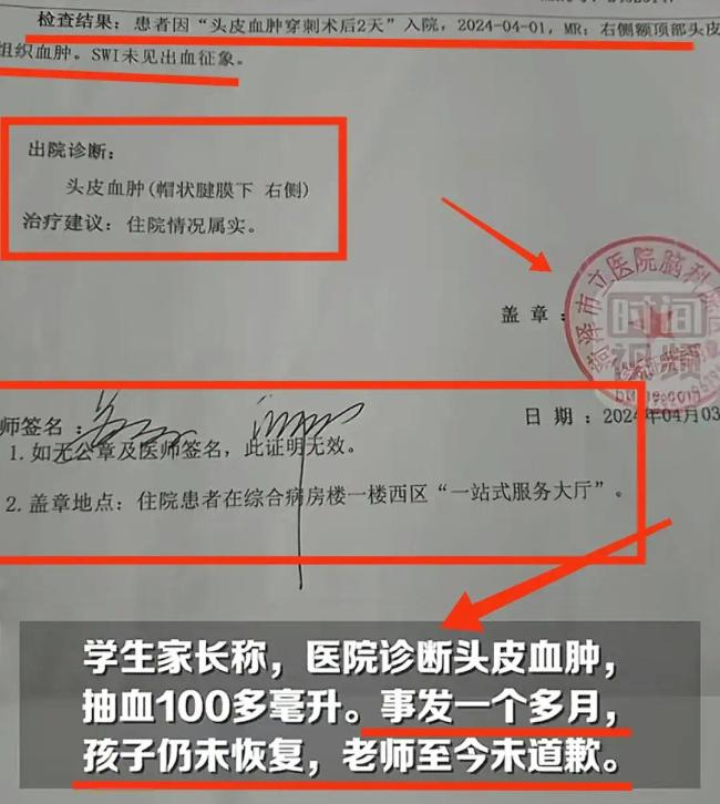 小学生被老师用戒尺打头致严重变形 只因不小心弄丢课本