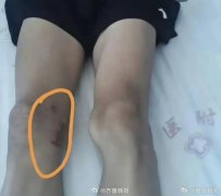 广西17岁体育生左腿长