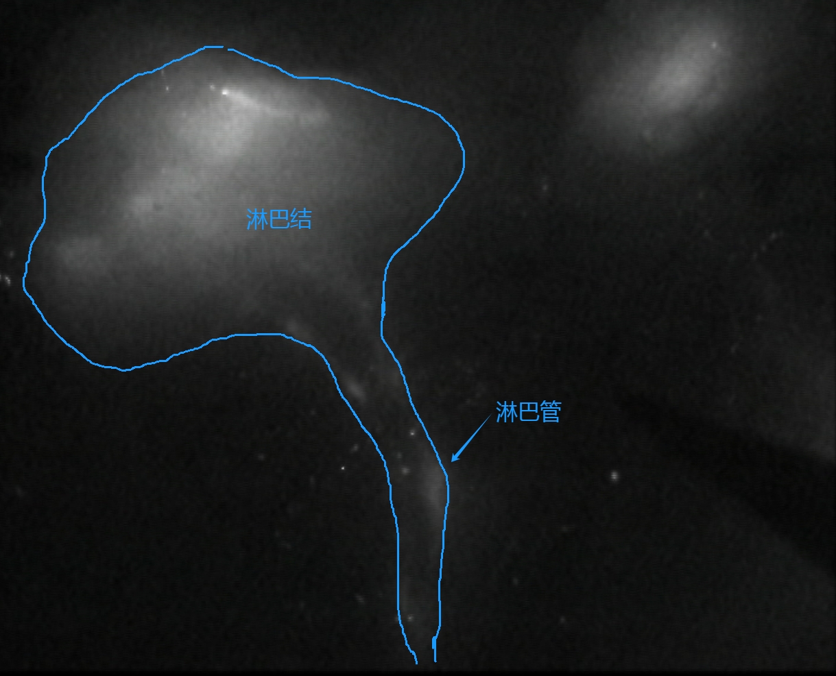LVA 荧光造影图.png