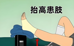 中老年人脚扭伤后肿
